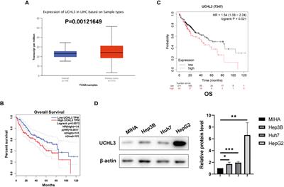 UCHL3 promotes hepatocellular carcinoma cell migration by de-ubiquitinating and stabilizing Vimentin